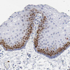 Immunohistochemical staining of human skin shows nuclear positivity in epidermal cells.