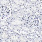 Anti-NCAPH Antibody