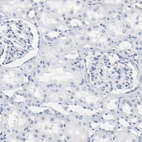 Immunohistochemical staining of human kidney shows no positivity as expected.