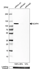 Western blot analysis in U2OS cells transfected with control siRNA, target specific siRNA probe #1 and #2, using Anti-NCAPH antibody. Remaining relative intensity is presented. Loading control: Anti-GAPDH.
