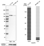 Western blot analysis in human cell lines U2OS and SK-MEL-30 using Anti-NCAPH antibody. Corresponding NCAPH RNA-seq data are presented for the same cell lines. Loading control: Anti-COX4I1.