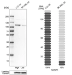 Western blot analysis in human cell lines U2OS and SK-MEL-30 using Anti-NCAPH antibody. Corresponding NCAPH RNA-seq data are presented for the same cell lines. Loading control: Anti-COX4I1.