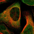 Immunofluorescent staining of human cell line U-2 OS shows localization to nucleus & cytosol.