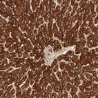 Anti-DLST Antibody