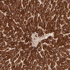 Immunohistochemical staining of human liver shows strong cytoplasmic positivity in hepatocytes.