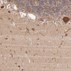 Immunohistochemical staining of human cerebellum shows strong cytoplasmic positivity in Purkinje cells.
