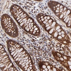 Immunohistochemical staining of human colon shows strong positivity in cytoplasm granular in glandular cells.