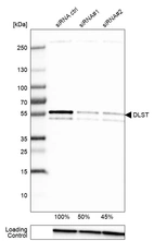 Western blot analysis in MCF-7 cells transfected with control siRNA, target specific siRNA probe #1 and #2, using Anti-DLST antibody. Remaining relative intensity is presented. Loading control: Anti-GAPDH.