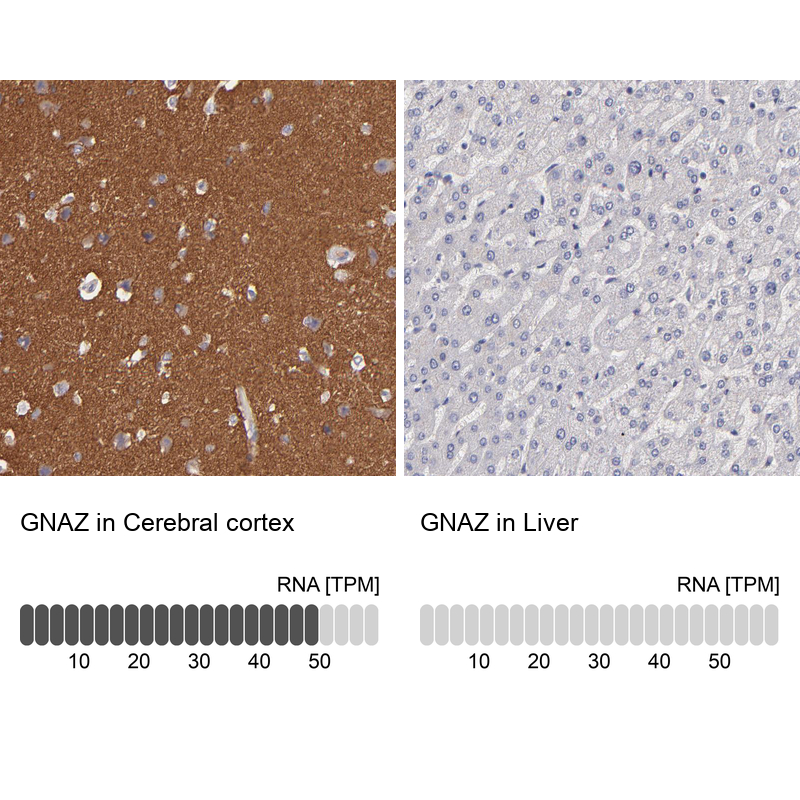Anti-GNAZ Antibody