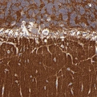 Immunohistochemical staining of human cerebellum shows strong cytoplasmic positivity in molecular layer.