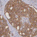 Immunohistochemical staining of human pancreas shows strong membranous positivity in islets of Langerhans.