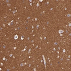 Immunohistochemical staining of human cerebral cortex shows strong cytoplasmic positivity in neuropil.