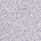 Anti-GNAZ Antibody