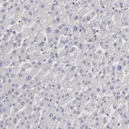 Immunohistochemical staining of human liver shows no positivity in hepatocytes as expected.