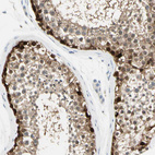 Anti-ASB9 Antibody