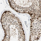 Immunohistochemical staining of human testis shows strong membranous positivity in cells in seminiferous ducts.