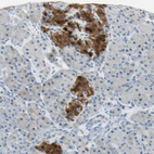 Anti-ASB9 Antibody