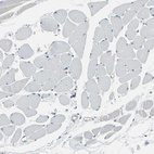 Immunohistochemical staining of human skeletal muscle shows no positivity in myocytes as expected.