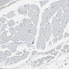 Immunohistochemical staining of human skeletal muscle shows no positivity in myocytes as expected.