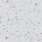 Anti-ASB9 Antibody