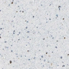 Immunohistochemical staining of human cerebral cortex shows no positivity in neurons as expected.