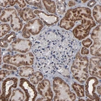 Immunohistochemical staining of human kidney shows strong granular cytoplasmic positivity in cells in tubules.