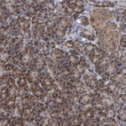 Immunohistochemical staining of human pancreas shows strong granular cytoplasmic positivity in exocrine glandular cells.
