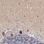 Anti-DACT1 Antibody