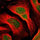 Immunofluorescent staining of human cell line U-2 OS shows localization to nucleoplasm.
