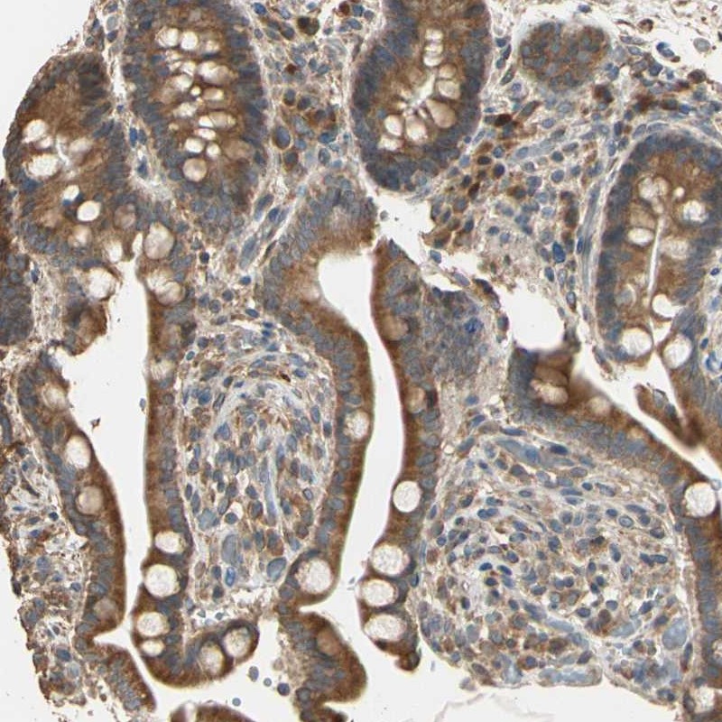 Anti-STX18 Antibody
