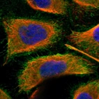 Immunofluorescent staining of human cell line A-431 shows localization to plasma membrane.