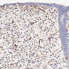 Immunohistochemical staining of human endometrium shows moderate cytoplasmic positivity in stromal cells.