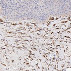 Anti-SPARC Antibody