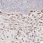 Immunohistochemical staining of human skin shows moderate cytoplasmic positivity in fibroblasts.