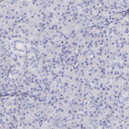 Anti-SPARC Antibody