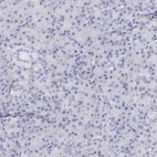 Immunohistochemical staining of human pancreas shows no positivity in exocrine glandular cells as expected.