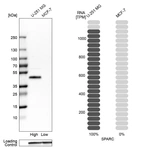 Western blot analysis in human cell lines U-251MG and MCF-7 using Anti-SPARC antibody. Corresponding SPARC RNA-seq data are presented for the same cell lines. Loading control: Anti-GAPDH.