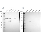 Anti-SPARC Antibody