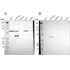 Western blot analysis using Anti-SPARC antibody HPA003020 (A) shows similar pattern to independent antibody HPA002989 (B).