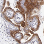 Anti-LHFPL1 Antibody