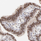 Anti-ZFP92 Antibody