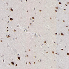 Immunohistochemical staining of human cerebral cortex shows strong nuclear positivity in neurons.
