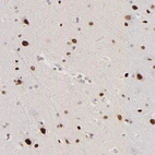 Immunohistochemical staining of human cerebral cortex shows strong nuclear positivity in neurons.