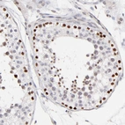 Immunohistochemical staining of human testis shows strong nuclear positivity in cells in seminiferous ducts.