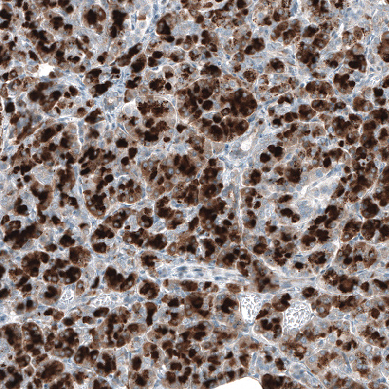 Anti-DHRSX Antibody