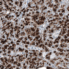 Anti-DHRSX Antibody