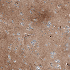 Immunohistochemical staining of human Cerebral cortex shows moderate cytoplasmic positivity in neuropil.