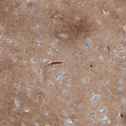 Immunohistochemical staining of human Cerebral cortex shows moderate cytoplasmic positivity in neuropil.