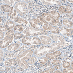 Immunohistochemical staining of human Kidney shows moderate cytoplasmic positivity in cells in tubules.