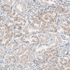 Immunohistochemical staining of human Kidney shows moderate cytoplasmic positivity in cells in tubules.